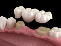 Omni Dental McMurray image 3